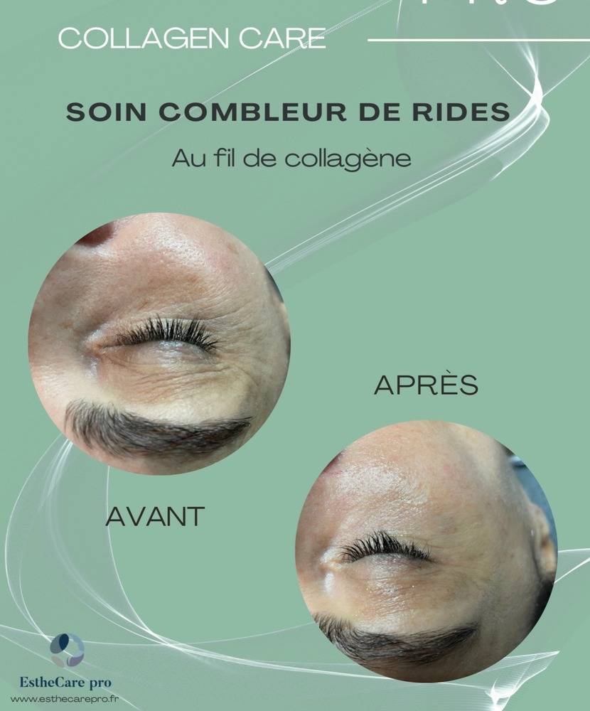 Collagène - Institut Beauté Océane